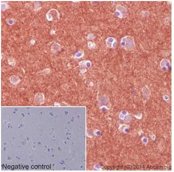 Immunohistochemistry (Formalin/PFA-fixed paraffin-embedded sections) - Anti-Pan Trk antibody [EPR17341] - BSA and Azide free (AB218577)