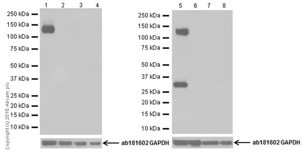 Western blot - Anti-Pan Trk antibody [EPR18413] (AB189903)