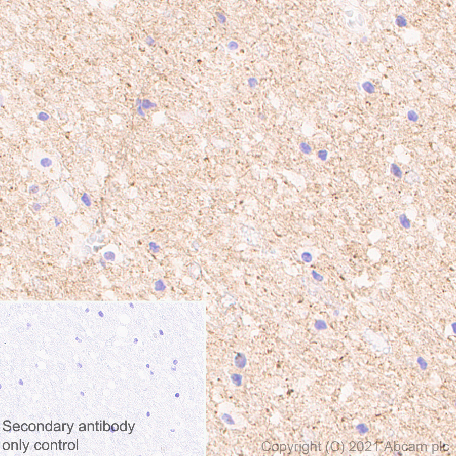 Immunohistochemistry (Formalin/PFA-fixed paraffin-embedded sections) - Anti-Pan Trk antibody [EPR24009-335] (ab267830), expandable thumbnail