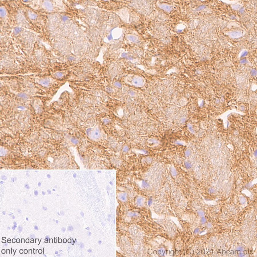 Immunohistochemistry (Formalin/PFA-fixed paraffin-embedded sections) - Anti-Pan Trk antibody [EPR24009-335] (ab267830), expandable thumbnail