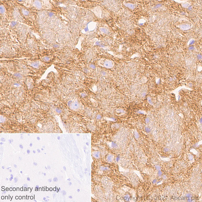 Immunohistochemistry (Formalin/PFA-fixed paraffin-embedded sections) - Anti-Pan Trk antibody [EPR24009-335] (AB267830)