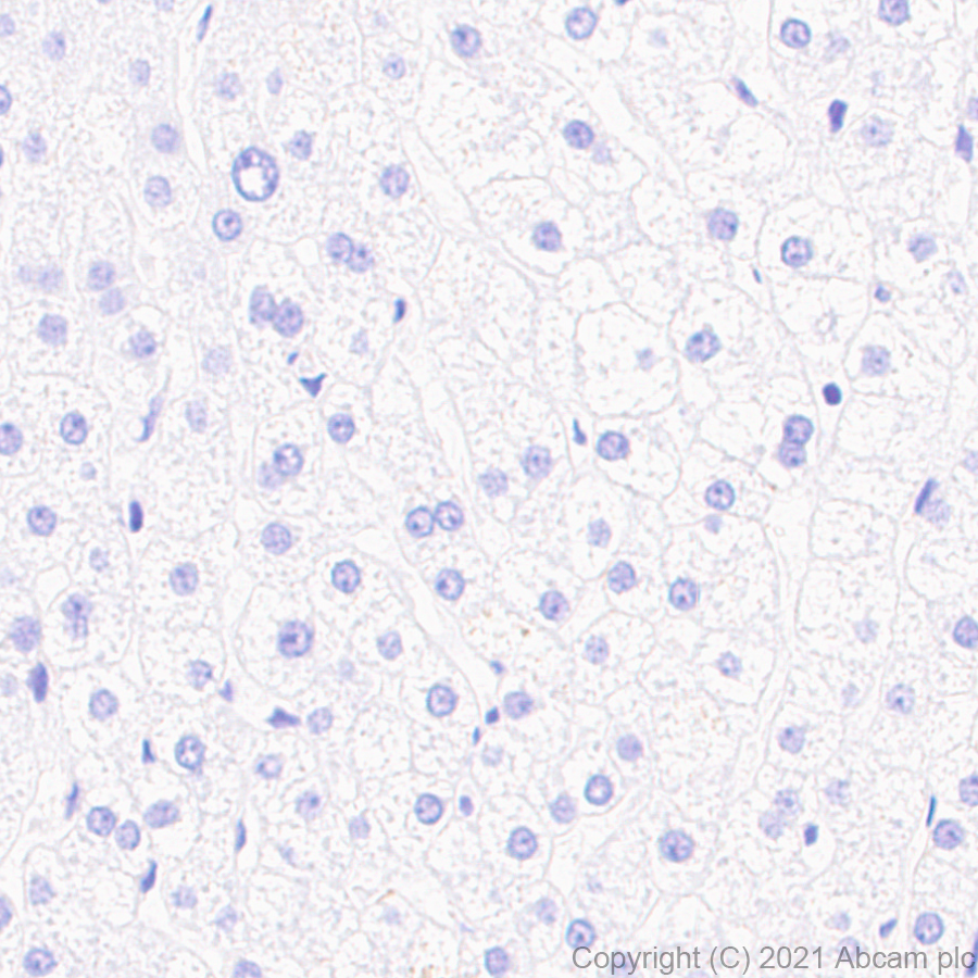 Immunohistochemistry (Formalin/PFA-fixed paraffin-embedded sections) - Anti-Pan Trk antibody [EPR24009-335] (ab267830), expandable thumbnail