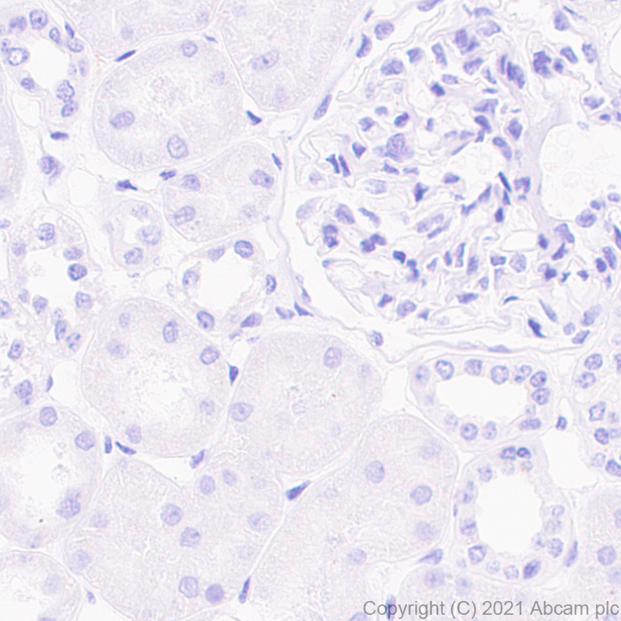 Immunohistochemistry (Formalin/PFA-fixed paraffin-embedded sections) - Anti-Pan Trk antibody [EPR24009-335] (ab267830), expandable thumbnail