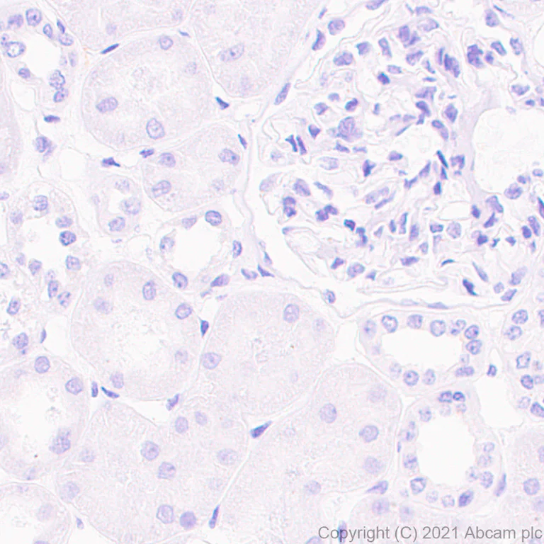 Immunohistochemistry (Formalin/PFA-fixed paraffin-embedded sections) - Anti-Pan Trk antibody [EPR24009-335] (AB267830)