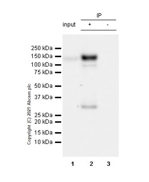 Immunoprecipitation - Anti-Pan Trk antibody [EPR24009-335] (ab267830), expandable thumbnail