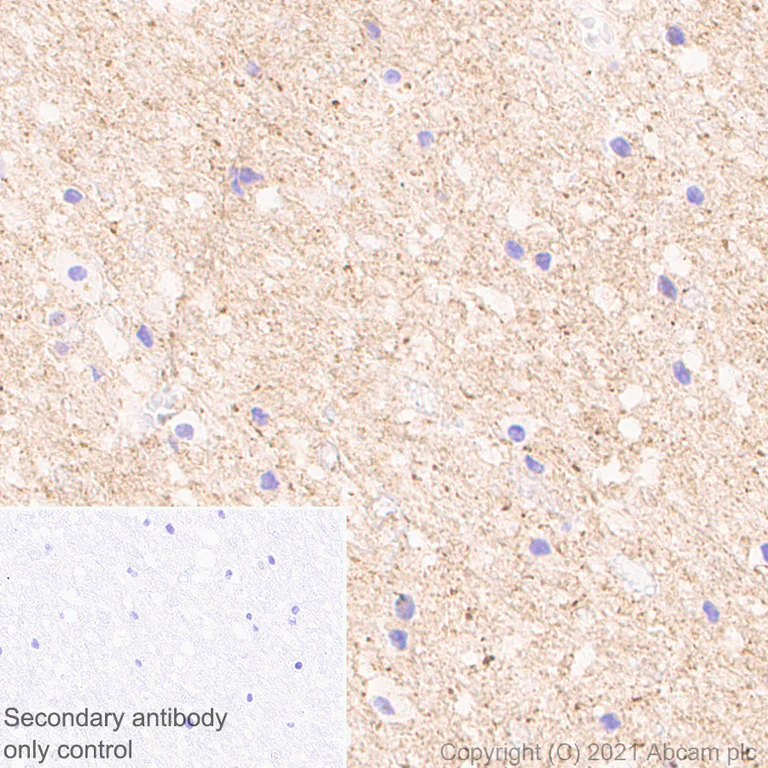 Immunohistochemistry (Formalin/PFA-fixed paraffin-embedded sections) - Anti-Pan Trk antibody [EPR24009-335] - BSA and Azide free (AB284409)