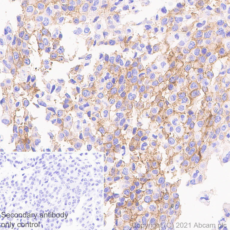 Immunohistochemistry (Formalin/PFA-fixed paraffin-embedded sections) - Anti-Pan Trk antibody [EPR24009-335] - BSA and Azide free (AB284409)