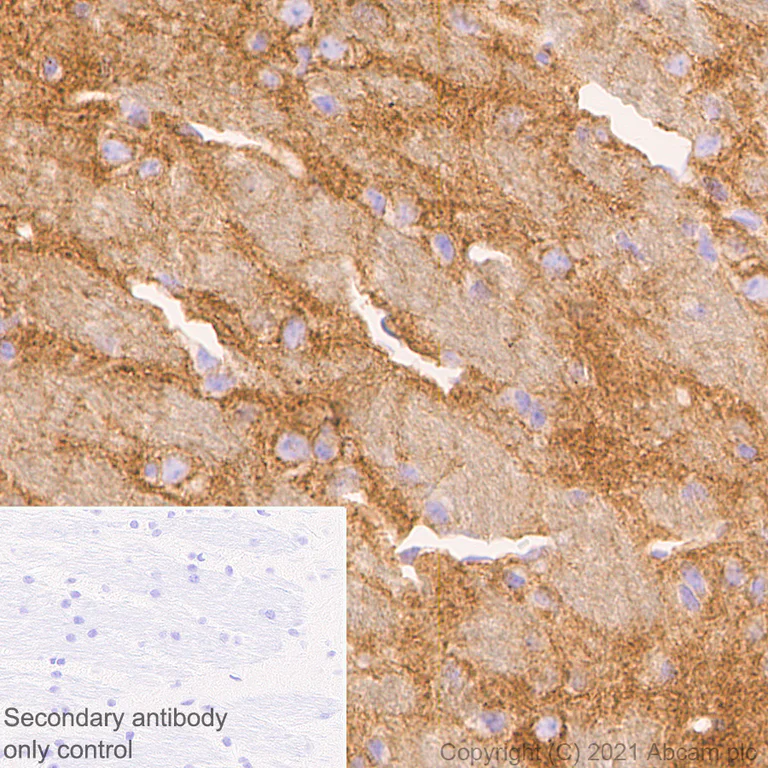 Immunohistochemistry (Formalin/PFA-fixed paraffin-embedded sections) - Anti-Pan Trk antibody [EPR24009-335] - BSA and Azide free (AB284409)