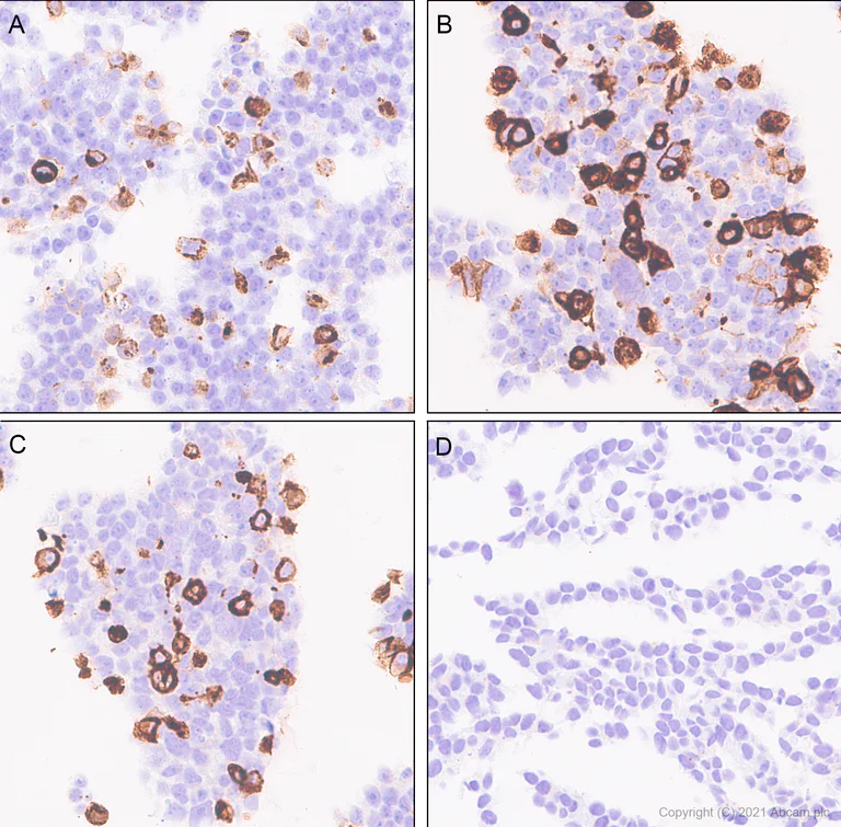 Immunohistochemistry (Formalin/PFA-fixed paraffin-embedded sections) - Anti-Pan Trk antibody [EPR24009-335] - BSA and Azide free (AB284409)