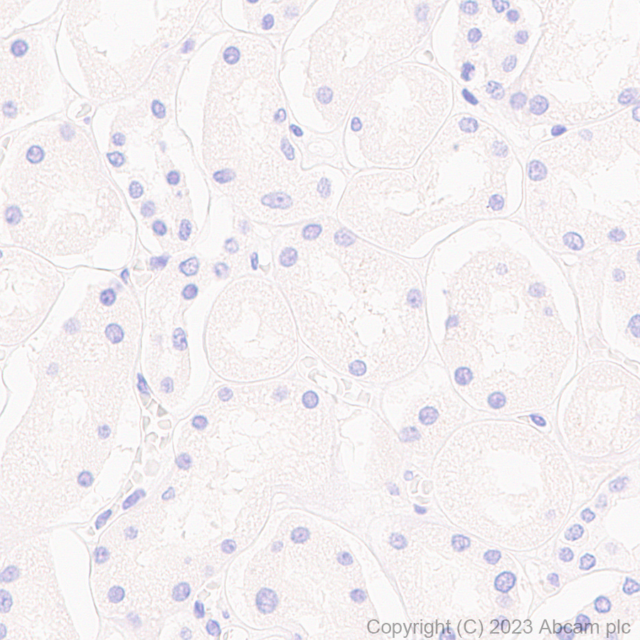 Immunohistochemistry (Formalin/PFA-fixed paraffin-embedded sections) - Anti-Pan Trk antibody [RM1032] (AB314906)