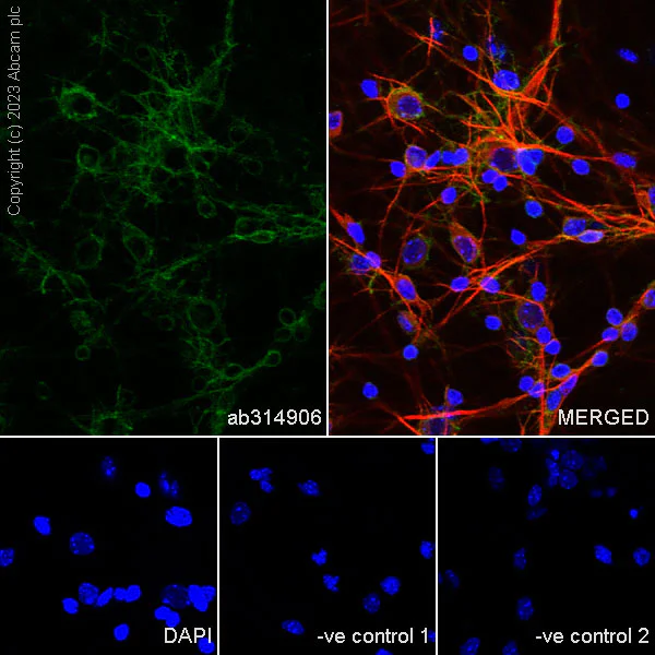 Immunocytochemistry/ Immunofluorescence - Anti-Pan Trk antibody [RM1032] - BSA and Azide free (AB314907)
