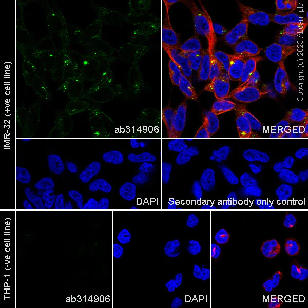 Immunocytochemistry/ Immunofluorescence - Anti-Pan Trk antibody [RM1032] - BSA and Azide free (AB314907)