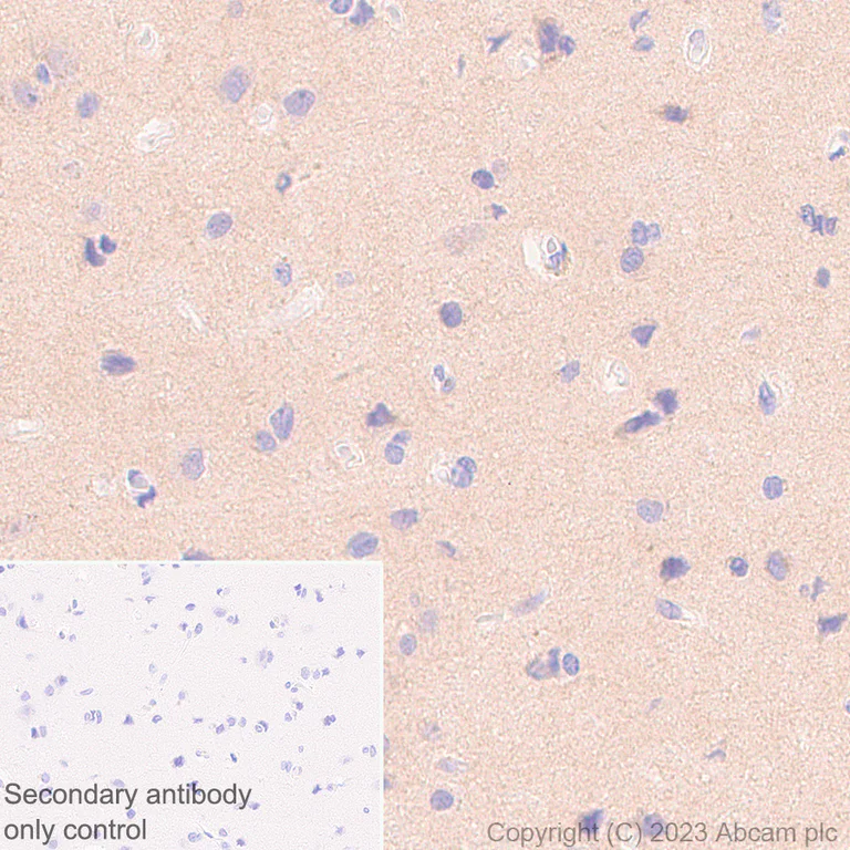 Immunohistochemistry (Formalin/PFA-fixed paraffin-embedded sections) - Anti-Pan Trk antibody [RM1032] - BSA and Azide free (AB314907)