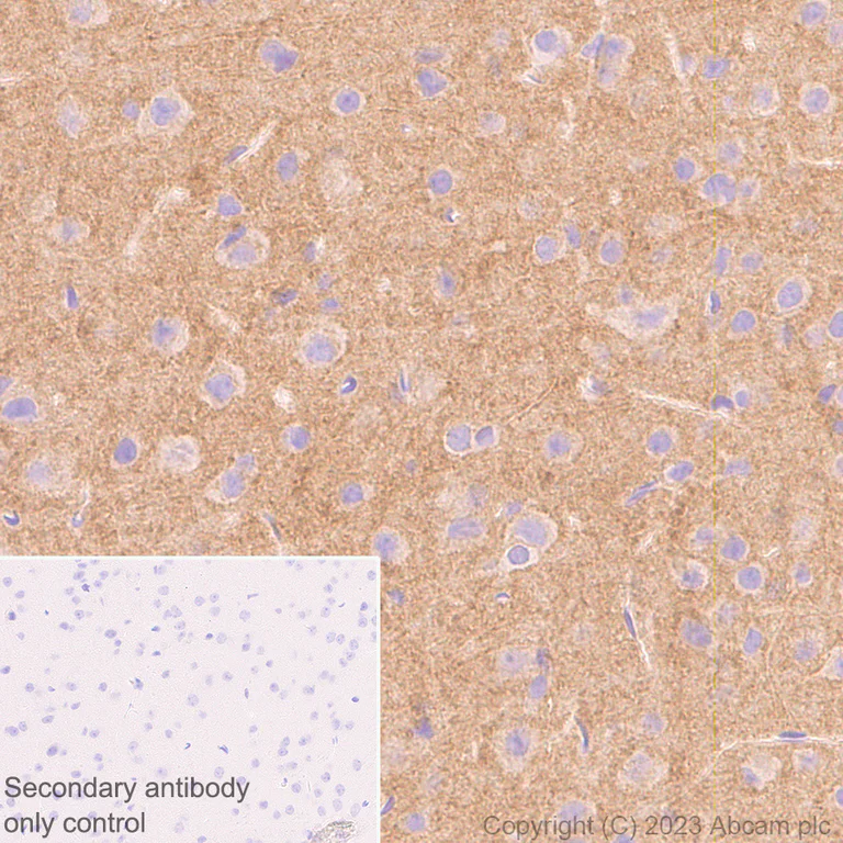 Immunohistochemistry (Formalin/PFA-fixed paraffin-embedded sections) - Anti-Pan Trk antibody [RM1032] - BSA and Azide free (AB314907)