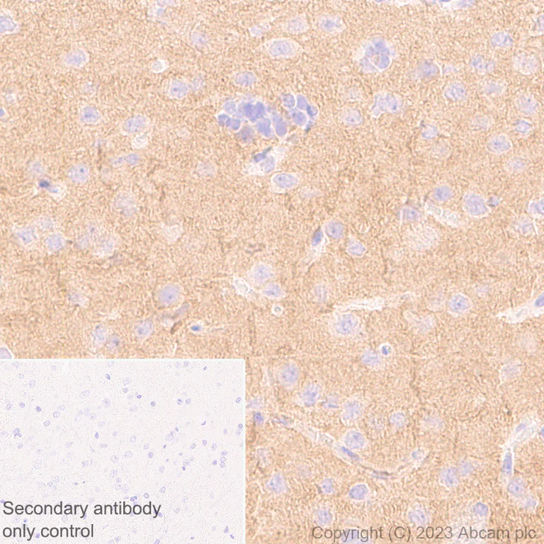 Immunohistochemistry (Formalin/PFA-fixed paraffin-embedded sections) - Anti-Pan Trk antibody [RM1032] - BSA and Azide free (AB314907)