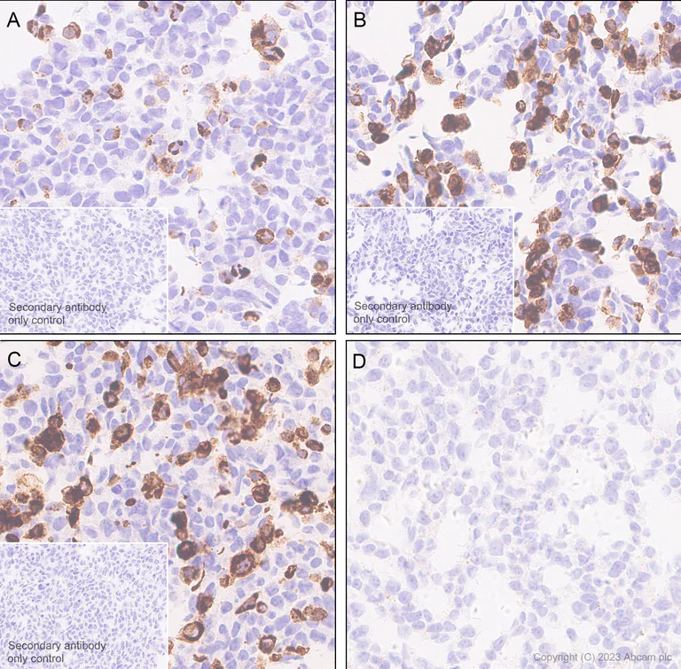 Immunohistochemistry (Formalin/PFA-fixed paraffin-embedded sections) - Anti-Pan Trk antibody [RM1032] - BSA and Azide free (AB314907)