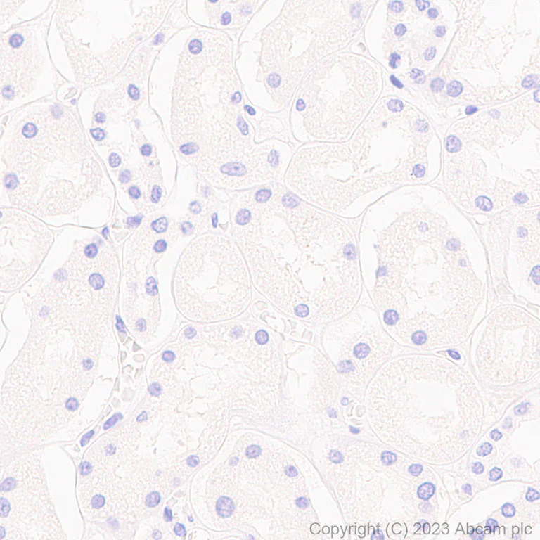 Immunohistochemistry (Formalin/PFA-fixed paraffin-embedded sections) - Anti-Pan Trk antibody [RM1032] - BSA and Azide free (AB314907)