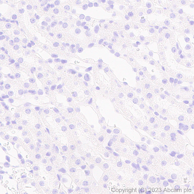 Immunohistochemistry (Formalin/PFA-fixed paraffin-embedded sections) - Anti-Pan Trk antibody [RM1032] - BSA and Azide free (AB314907)