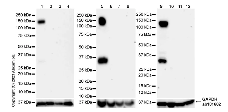 Western blot - Anti-Pan Trk antibody [RM1032] - BSA and Azide free (AB314907)