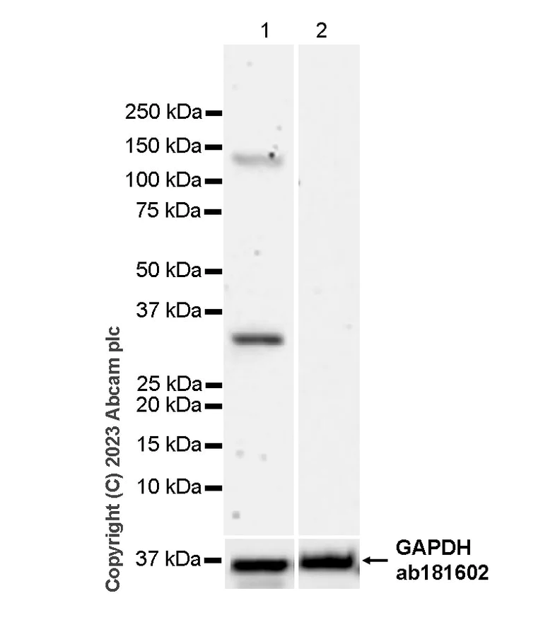 Western blot - Anti-Pan Trk antibody [RM1032] - BSA and Azide free (AB314907)