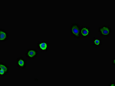 Immunocytochemistry/ Immunofluorescence - Anti-Pan2 antibody (AB222810)