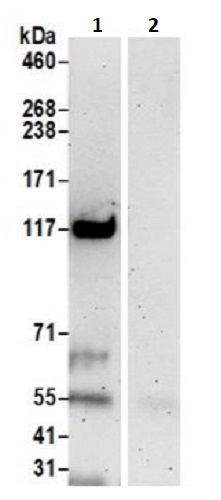 Immunoprecipitation - Anti-Pan2 antibody (AB241505)
