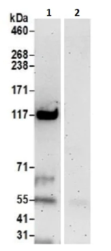 Immunoprecipitation - Anti-Pan2 antibody (AB241505)