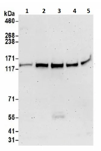 Western blot - Anti-Pan2 antibody (AB241505)