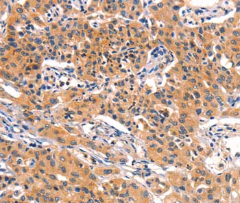 Immunohistochemistry (Formalin/PFA-fixed paraffin-embedded sections) - Anti-Pancreatic alpha amylase antibody (AB199132)