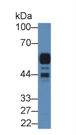 Western blot - Anti-Pancreatic alpha amylase antibody (AB231119)
