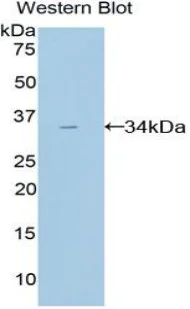 Western blot - Anti-Pancreatic alpha amylase antibody (AB231119)