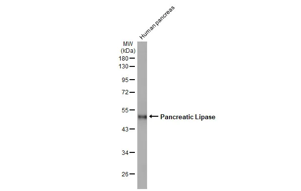 Western blot - Anti-Pancreatic Lipase antibody [HL1310] (AB308358)