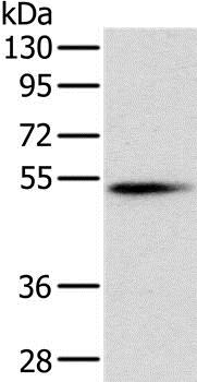 Western blot - Anti-Pancreatic Lipase/PTL antibody (AB198181)