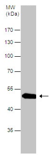 Western blot - Anti-Pancreatic Lipase/PTL antibody (AB228737)