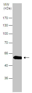 Western blot - Anti-Pancreatic Lipase/PTL antibody (AB228737)