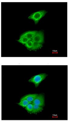 Immunocytochemistry/ Immunofluorescence - Anti-Pancreatic Lipase/PTL antibody (AB96100)