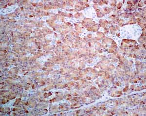 Immunohistochemistry (Formalin/PFA-fixed paraffin-embedded sections) - Anti-Pancreatic Lipase/PTL antibody [EPR6275] (AB133556)