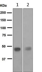 Western blot - Anti-Pancreatic Lipase/PTL antibody [EPR6276] (AB124915), expandable thumbnail