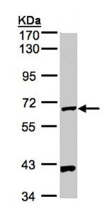 Western blot - Anti-PANK1 antibody (AB96173), expandable thumbnail