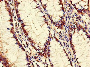 Immunohistochemistry (Formalin/PFA-fixed paraffin-embedded sections) - Anti-PANK2 antibody (AB223091)