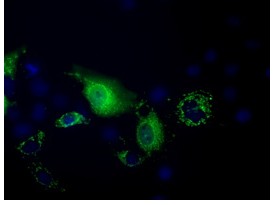 Immunocytochemistry/ Immunofluorescence - Anti-PANK2 antibody [OTI3H9] (AB119070), expandable thumbnail