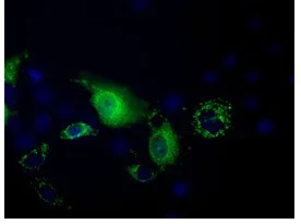 Immunocytochemistry/ Immunofluorescence - Anti-PANK2 antibody [OTI3H9] (AB119070)