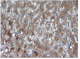 Immunohistochemistry (Formalin/PFA-fixed paraffin-embedded sections) - Anti-PANK2 antibody [OTI3H9] (AB119070), expandable thumbnail
