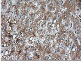 Immunohistochemistry (Formalin/PFA-fixed paraffin-embedded sections) - Anti-PANK2 antibody [OTI3H9] (AB119070)