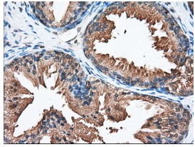 Immunohistochemistry (Formalin/PFA-fixed paraffin-embedded sections) - Anti-PANK2 antibody [OTI3H9] (AB119070), expandable thumbnail