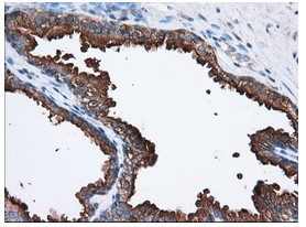 Immunohistochemistry (Formalin/PFA-fixed paraffin-embedded sections) - Anti-PANK2 antibody [OTI3H9] (ab119070), expandable thumbnail