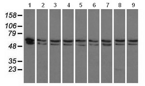 Western blot - Anti-PANK2 antibody [OTI3H9] (AB119070), expandable thumbnail
