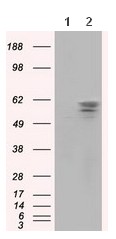 Western blot - Anti-PANK2 antibody [OTI3H9] (ab119070), expandable thumbnail