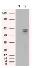 Western blot - Anti-PANK2 antibody [OTI3H9] (AB119070)
