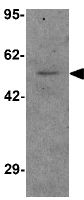 Western blot - Anti-Pannexin 1 antibody (AB139715)